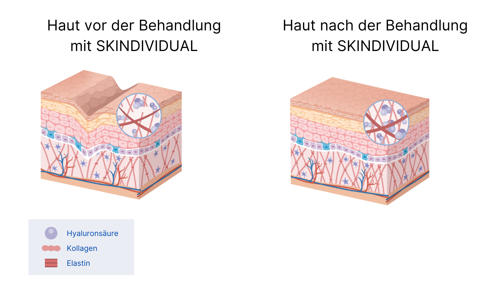 Vorher-Nachher Ergebnis