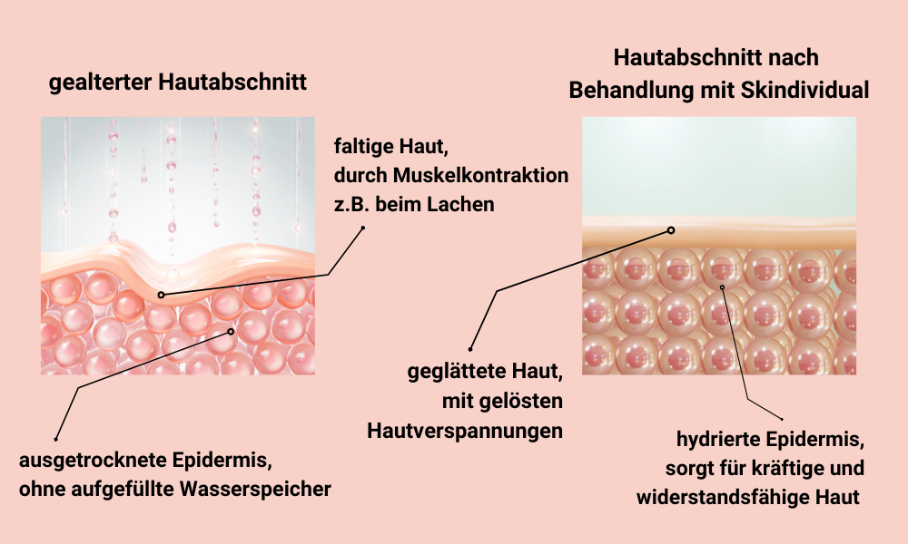 Gealterter Hautabschnitt