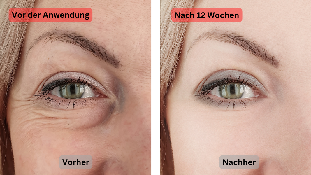 Beauty Complex Ergebnis