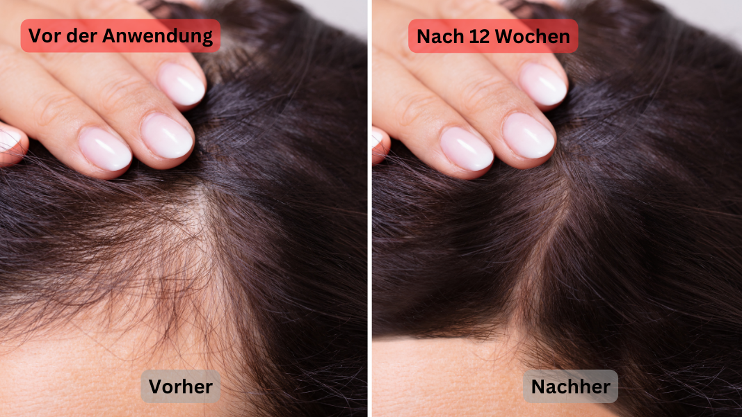 Beauty Complex Anwendung