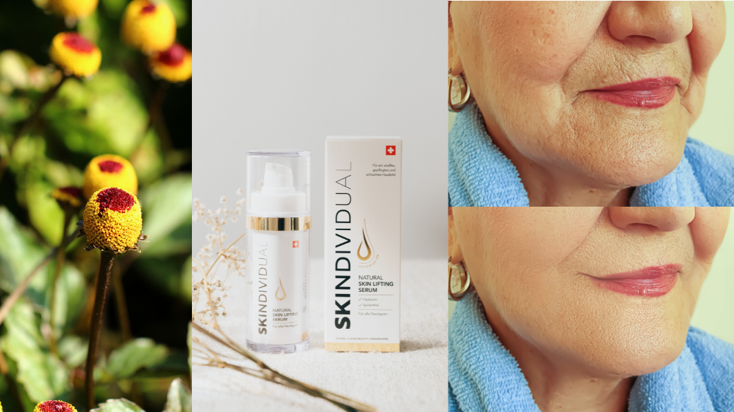 Meine beste Freundin - SKINDIVIDUAL Erfahrung